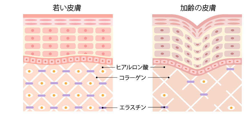 水光注射の主な特徴と効果