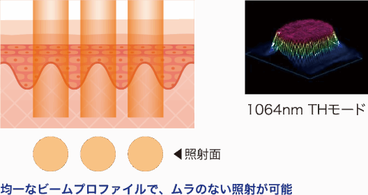 均一なビームプロファイルで、ムラのない照射が可能