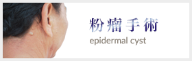 粉瘤